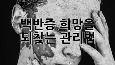 백반증, 희망을 되찾는 관리법
